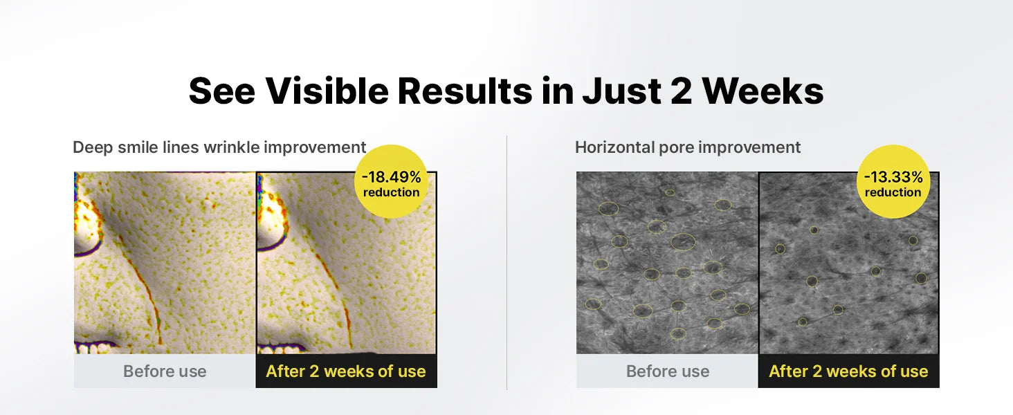 Vetrix® Retinal Shot – Piel Renovada